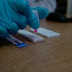 SSM realiza sin costo prueba rápida para detectar la hepatitis C