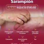 ¿Fiebre y manchas rojas? Podría ser sarampión; conoce los síntomas según la SSM